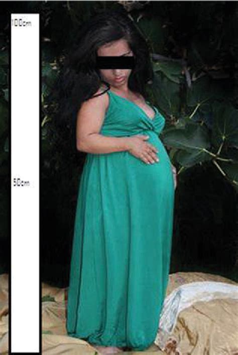 pregnant midget|Pregnancy in a woman with proportionate (primordial) dwarfism: a .